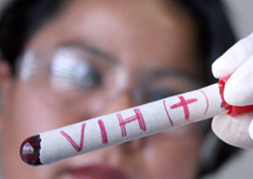 12 mil personas viven con VIH en RD y no lo saben