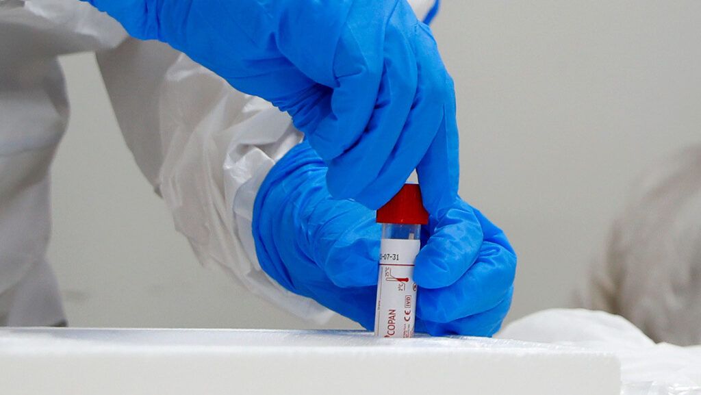 Fármaco en pruebas podría bloquear el coronavirus