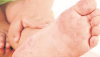 El “Kawasaki” ya esta en RD y en Santiago lo saben