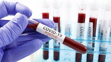 República Dominicana registra 1,044 nuevos contagios de COVID-19