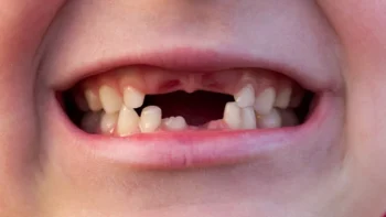 Crean fármaco que regenera los dientes que se han caído