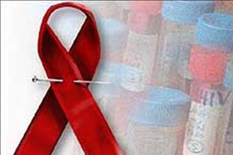 SP anuncia apoyará programas prevención y control del VIH-SIDA