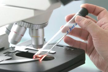 Asegura situación de tuberculosis en el mundo es peor que en años 80