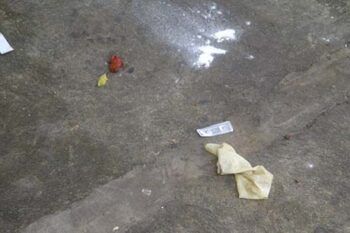 Denuncian falta de higiene de Centro de Cirugía Plástica