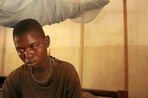 Niño centroafricano afectado por la enfermedad del sueño. Foto de RAQUEL VILLAÉCIJA / EL MUNDO