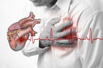 Los síntomas de un infarto comienzan un mes antes