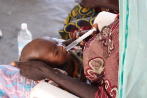 Niño afectado por desnutrición severa en un hopspital de Nigeria. Foto: OCHA/O.Fagan/ONU