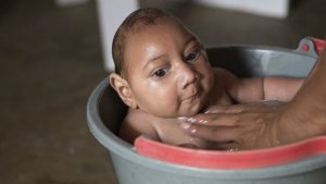 Niño con microcefalia. Foto tomada de la BBC 