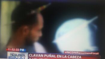 Le dan puñala en la cabeza y vive para contarlo