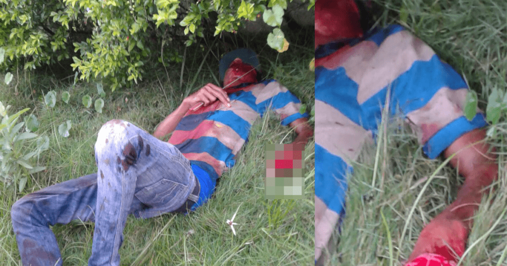 Un familiar le corta la mano por pegarle a su propia madre