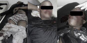 Cuando hicieron contacto con la patrulla de la Policía, se produjo el tiroteo y los reventaron.