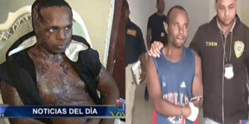 Estaba durmiendo y de repente siente un doloroso ardor en su oído, cuando se despierta, se lleva esta desagradable sorpresa.