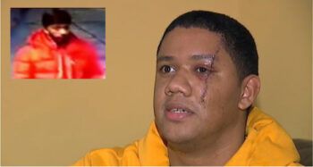 Barbero dominicano es herido en la cara por un cliente en NY