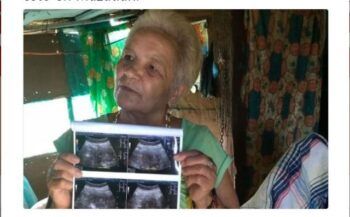 Señora de 70 años asegura que está embarazada.