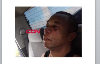 Sindicalista Blas Peralta permanece en centro médico tras ser agredido con un palo