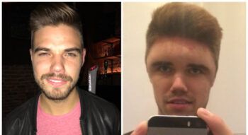 Así quedo este hombre luego de teñirse el pelo