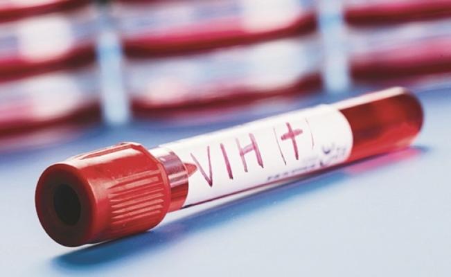 En el país hay 67 mil personas con VIH