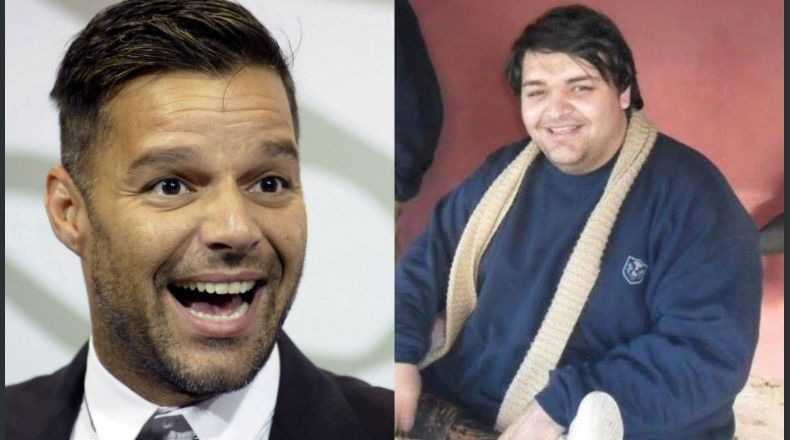 Hombre se hizo más de 27 cirugías para verse como Ricky Martin 