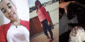 Patanista impacta vehículo donde se desplazaba esta joven con un lamentable resultado.