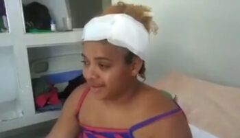 Joven recibe disparo en la cabeza por parte de su pareja.