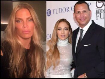 Alex Rodríguez con un ojo abollao