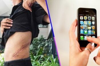 Joven chino que vendió riñón para comprarse un celular quedará postrado en cama de por vida