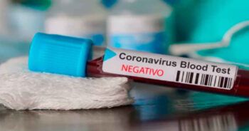 Aseguran el coronavirus es cada vez menos agresivo