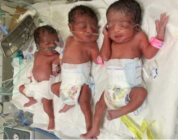 Niña de 15 años da a luz a trillizos
