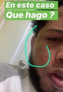 Chimbala denuncia que su esposa le da golpes