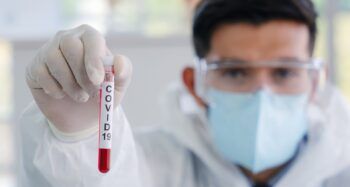 RD: registra cuatro muertes y 883 contagios por COVID-19