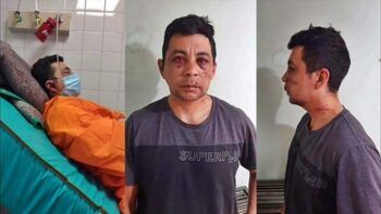 Golpean, roban y queman la casa de enfermero que tuvo Covid-19