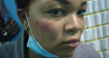 Acusan diputado del PRM de agredir a una agente policial en Cotuí  