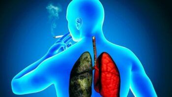 Problemas pulmonares son las principales secuelas del COVID-19