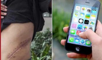 Vendió un riñón para comprar un iphone y ahora podría perder la vida