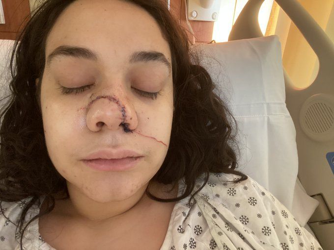 Cliente le cortó la cara a empleada latina en boutique del Alto Manhattan