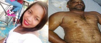 Lanzan “ácido del diablo” a regidor y esposa mientras dormían