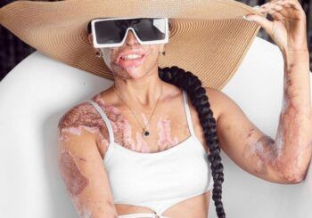 Yocairy Amarante luce sus imperfecciones mientras posa en traje de baño