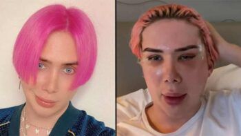 Influencer se somete a 18 cirugías para ‘convertirse’ en coreano