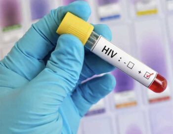 Buscan reducir las nuevas infecciones por VIH