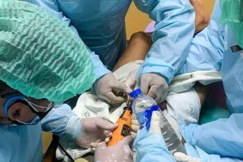 Joven muere tras sellar su miembro con pegamento