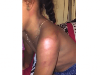 Mujer agrede brutalmente a sobrina de 7 años en Monte Plata