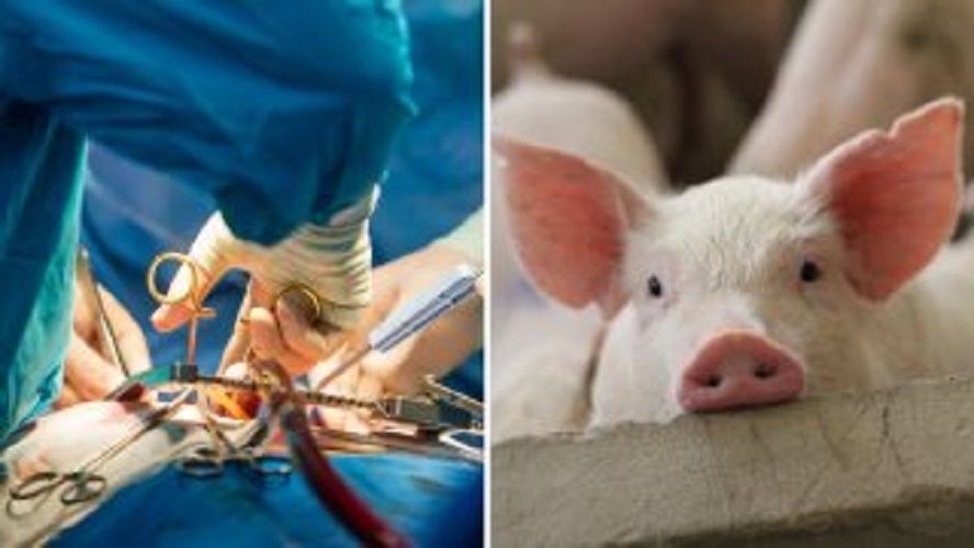 Realizan con éxito el primer trasplante experimental de un riñón de cerdo a un ser humano