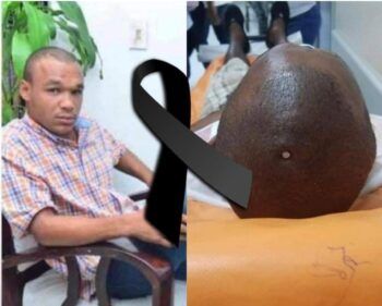 Muere joven que se perforó la cabeza con un clavo