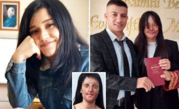 Mujer se casa con el hombre que le lanzó ácido al rostro dejándola casi ciega