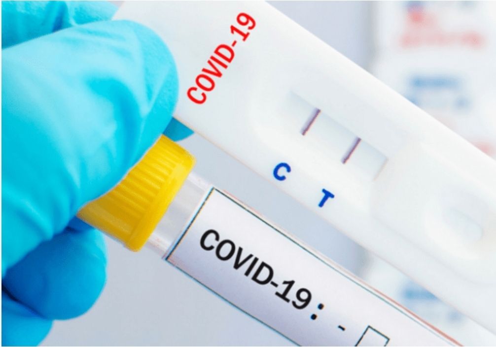 Permiten la venta libre de pruebas antígeno del Covid-19; farmacias las expedirán