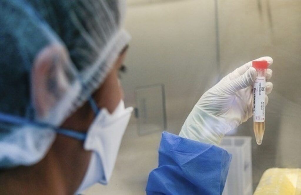 RD bajo vigilancia epidemiológica