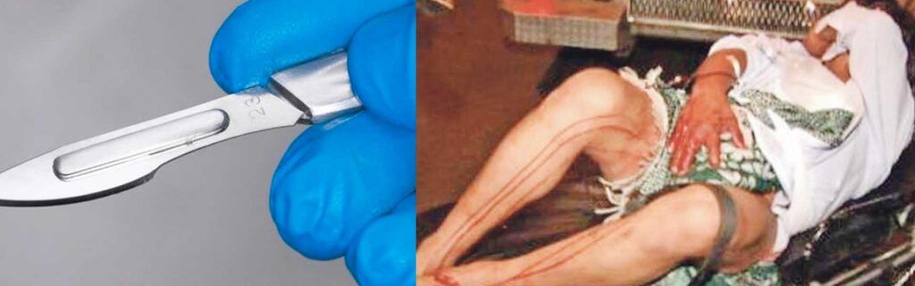 Le cortó el pene a su esposo al hallarlo abusando de su niña
