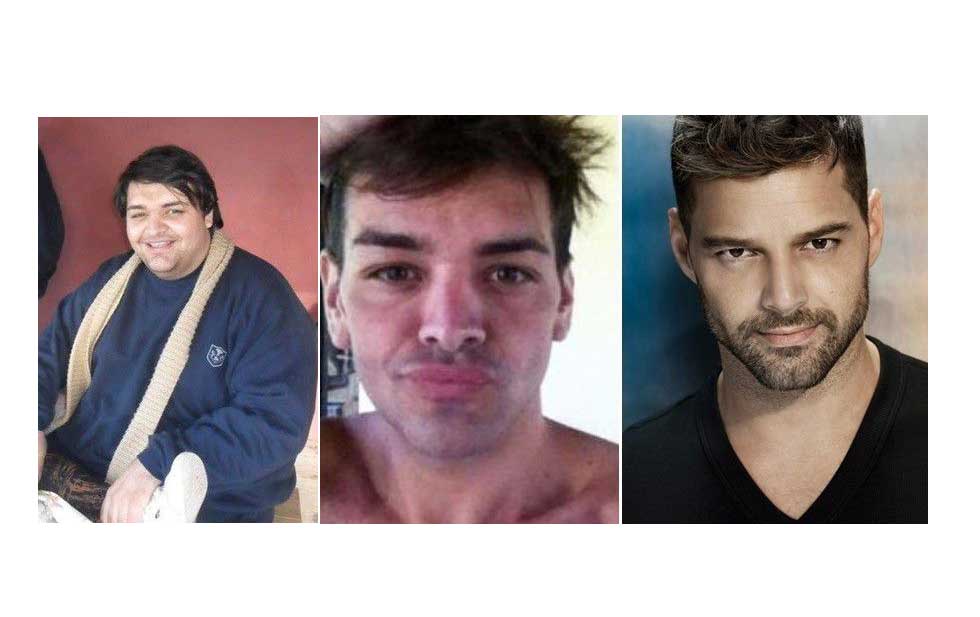 Se operó 27 veces para parecerse a Ricky Martin