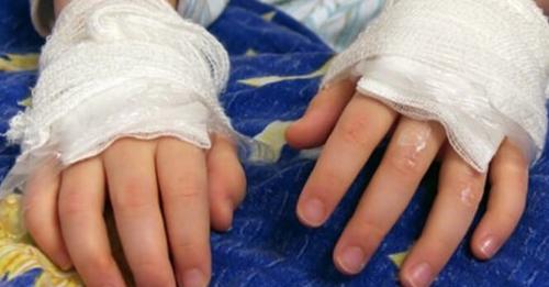 Apresan mujer que quemó las manos de su hijo de 6 años en La Vega