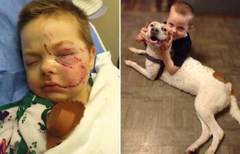 Niño es atacado por su propio perro